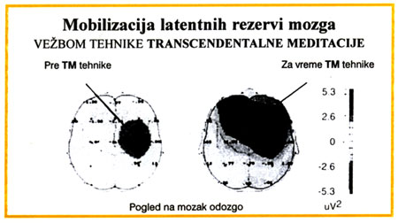 Meditacija 2